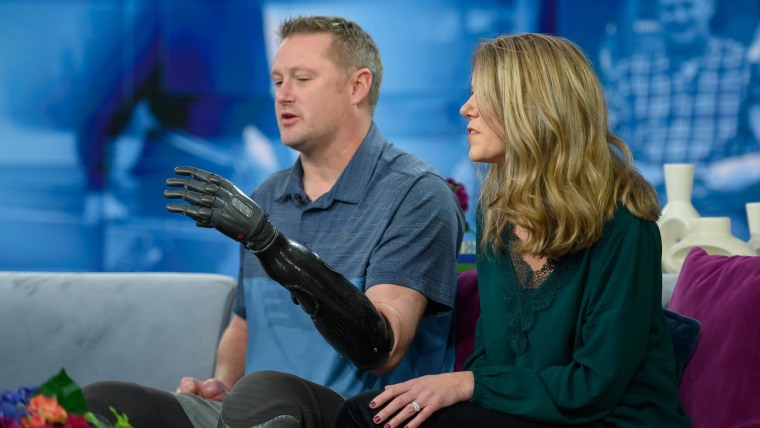 Woman Who Lost Fingers In Woodworking Accident Gets Prosthesis New Outlook On Life